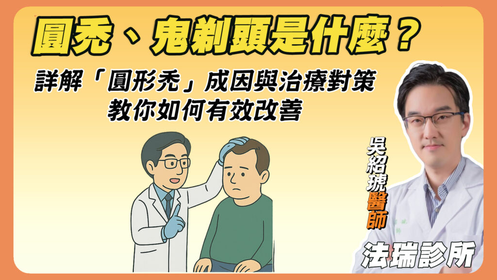 圓禿、鬼剃頭是什麼？醫師詳解「圓形禿」成因與治療對策，教你如何有效改善